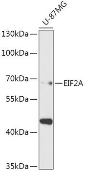 Western blot analysis of extracts of
U-87MG cells, using EIF2A antibody
at 1:1000 dilution.
Secondary antibody: HRP Goat Anti-
Rabbit IgG (H+L) at 1:10000
dilution.
Lysates/proteins: 25ug per lane.
Blocking buffer: 3% nonfat dry milk in
TBST.
Detection: ECL Basic Kit.
Exposure time: 90s.