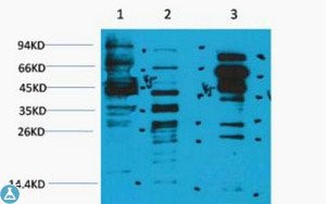 Western Blot (WB) analysis of 1) HeLa, 2) 3T3, 3) Rat Brain, diluted at 1:2000.