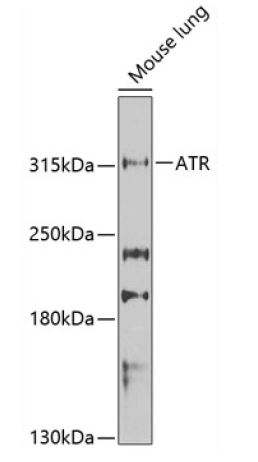 Western blot analysis of extracts of Mouse lung cells, using ATR Antibody at 1:1000 dilution.
Secondary antibody: HRP Goat Anti-Rabbit IgG (H+L) at 1:10000 dilution.
Lysates/proteins: 25ug per lane.
Blocking buffer: 3% nonfat dry milk in TBST.
Detection: ECL West Pico Plus Kit
Exposure time: 90s.