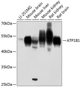 Western blot analysis of extracts of
various cell lines, using ATP1B1
antibody at 1:1000 dilution.
Secondary antibody: HRP Goat Anti-
Rabbit IgG (H+L) at 1:10000
dilution.
Lysates/proteins: 25ug per lane.
Blocking buffer: 3% nonfat dry milk in
TBST.Detection: ECL Basic Kit.
Exposure time: 10s.