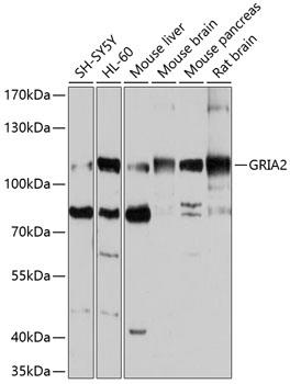 Western blot analysis of extracts of various cell lines, using GRIA2 antibody ) at 1:1000 dilution.  Secondary antibody: HRP Goat Anti-Rabbit IgG (H+L) at 1:10000 dilution.
Lysates/proteins: 25ug per lane.
Blocking buffer: 3% nonfat dry milk in TBST.
Detection: ECL West Pico Plus. 
Exposure time: 10s.