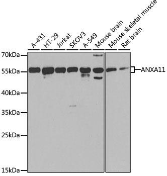 Western blot analysis of extracts of
various cell lines, using ANXA11
antibody at 1:1000 dilution.
Secondary antibody: HRP Goat Anti-
Rabbit IgG (H+L)at 1:10000
dilution.
Lysates/proteins: 25ug per lane.
Blocking buffer: 3% nonfat dry milk in
TBST.
Detection: ECL West Pico Plus .
Exposure time: 30s.