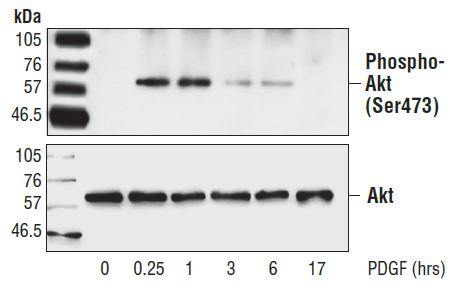 Western blot analysis of extracts from NIH/3T3 cells, untreated or PDGF-treated (50 ng/ml) for the indicated times, using Phospho-Akt (Ser473) Antibody (upper) or Akt Antibody (lower).