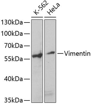 Western blot analysis of extracts of
various cell lines, using Vimentin
antibody at 1:1000 dilution.
Secondary antibody: HRP Goat Anti-
Rabbit IgG (H+L)at 1:10000
dilution.
Lysates/proteins: 25ug per lane.
Blocking buffer: 3% nonfat dry milk in
TBST.
Detection: ECL West Pico Plus.
Exposure time: 90s.