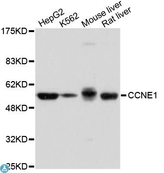 Western blot analysis of extracts of various cell lines, using Cyclin E antibody.
Secondary antibody:
HRP Goat Anti-Rabbit IgG (H+L) at 1:10000 dilution. Lysates/proteins: 25ug per lane.
Blocking buffer: 3% nonfat dry milk in TBST.