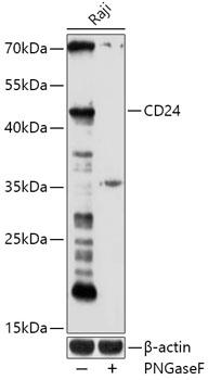 Western blot analysis of extracts of
Raji cells, using CD24 antibody
at 1:1000 dilution.
Secondary antibody:
HRP Goat Anti-Rabbit IgG (H+L)  at 1:10000  dilution.
Lysates/proteins: 25ug per lane.
Blocking buffer: 3% nonfat dry milk in TBST.
Detection: ECL West Pico Plus.  
Exposure time: 180s.