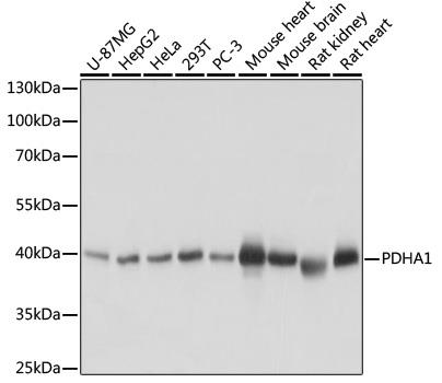 Western blot analysis of extracts of various cell lines, using PDHA1
antibody at 1:1000 dilution.
Secondary antibody: HRP Goat Anti- Rabbit IgG (H+L) at 1:10000 dilution.
Lysates/proteins: 25ug per lane.
Blocking buffer: 3% nonfat dry milk in TBST.
Detection: ECL West Pico Plus.
Exposure time: 5s.