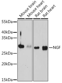 Western blot analysis of extracts of
various cell lines, using NGF antibody
at 1:1000 dilution.
Secondary antibody: HRP Goat Anti-
Rabbit IgG (H+L) at 1:10000
dilution.
Lysates/proteins: 25ug per lane.
Blocking buffer: 3% nonfat dry milk in
TBST.
Detection: ECL West Pico Plus.     
Exposure time: 180s.