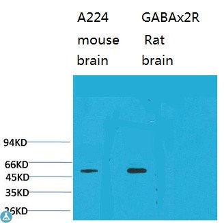 Western Blot (WB) analysis of 1) Mouse Brain Tissue
, 2)Rat Brain Tissue with GABA A Receptor alpha2
Rabbit Polyclonal Antibody diluted at 1:2000.