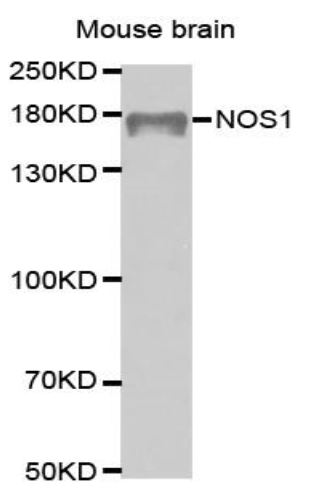 Western blot analysis of extracts of mouse brain cell line, using NOS1 antibody.