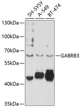 Western blot analysis of extracts of
various cell lines, using GABRB3
antibodyat 1:1000 dilution.
Secondary antibody: HRP Goat Anti-
Rabbit IgG (H+L) at 1:10000
dilution.
Lysates/proteins: 25ug per lane.
Blocking buffer: 3% nonfat dry milk in
TBST.
Detection: ECL West Pico Plus.
Exposure time: 60s.