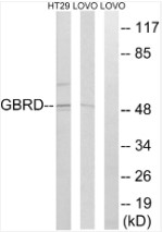 Lysates from LOVO and HT-29 cells.
The lane on the right is blocked
with the synthesized peptide.