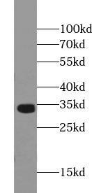 Y79 cells were subjected to SDS PAGE followed by western blot with (OTX2 antibody) at dilution of 1:500