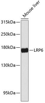 Western blot analysis of extracts of
mouse liver, using LRP6 antibody
 at 1:1000 dilution.
Secondary antibody: HRP Goat Anti-
Rabbit IgG (H+L) at 1:10000
dilution.
Lysates/proteins: 25ug per lane.
Blocking buffer: 3% nonfat dry milk in
TBST.
Detection: ECL West Pico Plus 
Exposure time: 60s.