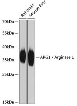 Western blot analysis of extracts of various cell lines, using ARG1 /Arginase 1 Antibody at 1:2000 dilution.
Secondary antibody: HRP Goat Anti-Rabbit IgG (H+L) at 1:10000 dilution.
Lysates/proteins: 25ug per lane.
Blocking buffer: 3% nonfat dry milk in TBST.
Detection: ECL West Pico Plus.    
Exposure time: 1s.