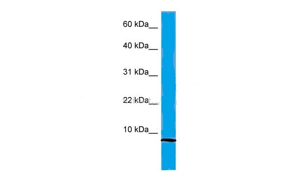 Western Blot  Suggested Anti- hBD2 Antibody Titration: 0.2-1 ug/ml ELISA Titer: 1:62500
Positive Control: Human Placenta