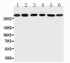 Anti-Mucin 5AC antibody,  All Western blotting
All lanes: Anti-MUC5AC at0.5ug/ml
Lane 1: SGC Whole Cell Lysate at 40ug
Lane 2: HELA Whole Cell Lysate at 40ug
Lane 3: COLO320 Whole Cell Lysate at 40ug
Lane 4: SW620 Whole Cell Lysate at 40ug
Lane 5: MCF-7 Whole Cell Lysate at 40ug
Lane 6: PANC Whole Cell Lysate at 40ug
Predicted bind size: 527KD
Observed bind size: 300KD