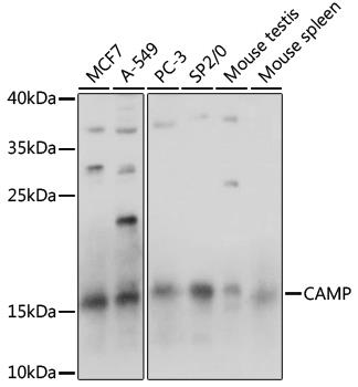 Western blot analysis of extracts of various cell lines, using LL-37  antibody at 1:1000 dilution.
Secondary antibody: HRP Goat Anti- Rabbit IgG (H+L) at 1:10000
dilution.Lysates/proteins: 25ug per lane.Blocking buffer: 3% nonfat dry milk in TBST.
Detection: ECL West Pico Plus. 
Exposure time: 10s.
