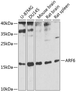 Western blot analysis of extracts of
various cell lines, using ARF6
antibody at 1:1000 dilution.
Secondary antibody: HRP Goat Anti-
Rabbit IgG (H+L) at 1:10000
dilution.
Lysates/proteins: 25ug per lane.
Blocking buffer: 3% nonfat dry milk in
TBST.
Detection: ECL West Pico Plus.
Exposure time: 10s.