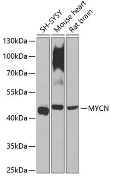 Western blot analysis of extracts of various cell lines, using MYCN
antibody at 1:1000 dilution.
Secondary antibody: HRP Goat Anti- Rabbit IgG (H+L) at 1:10000 dilution.
Lysates/proteins: 25ug per lane.
Blocking buffer: 3% nonfat dry milk in TBST.
Detection: ECL West Pico Plus.
Exposure time: 90s.