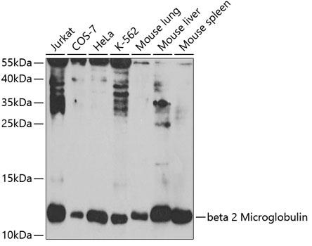 Western blot analysis of extracts of
various cell lines, using beta 2
Microglobulin antibody at
1:1000 dilution.
Secondary antibody: HRP Goat Anti-
Rabbit IgG (H+L) at 1:10000
dilution.
Lysates/proteins: 25ug per lane.
Blocking buffer: 3% nonfat dry milk in
TBST.
