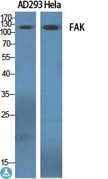 Western Blot (WB) analysis of specific cells using FAK polyclonal antibody.