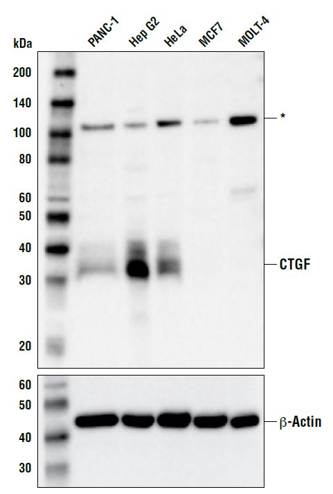 Western blot analysis of extracts from various cell
lines using CTGF Rabbit pAb (upper) and β-actin
(D6A8) Rabbit B Actin lower). Asterisk indicates a
120 kDa band of unknown identity detected by this
antibody in Western blot analysis.