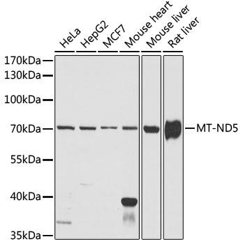 Western blot analysis of extracts of various cell lines, using MT-ND5 antibody at 1:1000 dilution.
Secondary antibody: HRP Goat Anti- Rabbit IgG (H+L) at 1:10000 dilution.
Lysates/proteins: 25ug per lane.
Blocking buffer: 3% nonfat dry milk in TBST.
Detection: ECL West Pico Plus.
Exposure time: 3min.