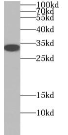 Human brain tissue were subjected to SDS PAGE followed by western blot with OLIG2 antibody at dilution of 1:600