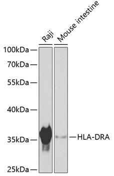 Western blot analysis of extracts of
various cell lines, using HLA-DRA
antibody at 1:1000 dilution.
Secondary antibody: HRP Goat Anti-
Rabbit IgG (H+L) at 1:10000
dilution.
Lysates/proteins: 25ug per lane.
Blocking buffer: 3% nonfat dry milk in
TBST.
