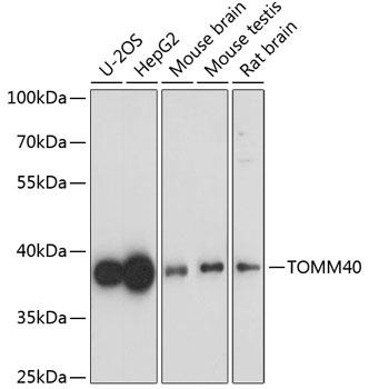 Western blot analysis of extracts of
various cell lines, using TOMM40
antibody at 1:1000 dilution.
Secondary antibody: HRP Goat Anti-
Rabbit IgG (H+L) at 1:10000
dilution.
Lysates/proteins: 25ug per lane.
Blocking buffer: 3% nonfat dry milk in
TBST.
Detection: ECL West Pico Plus.
Exposure time: 60s.