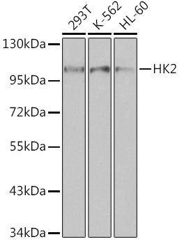 Western blot analysis of extracts of
various cell lines, using HK2 antibody at 1:1000 dilution.
Secondary antibody: HRP Goat Anti-
Rabbit IgG (H+L) at 1:10000
dilution.
Lysates/proteins: 25ug per lane.
Blocking buffer: 3% nonfat dry milk in
TBST.