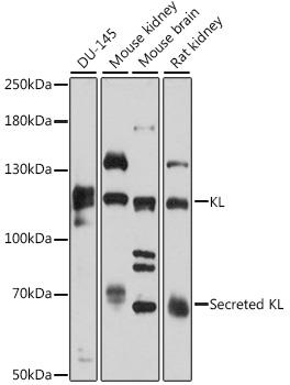 Western blot analysis of extracts of various cell lines, using KL antibody at 1:3000 dilution.
Secondary antibody: HRP Goat Anti-
Rabbit IgG (H+L) at 1:10000
dilution.
Lysates/proteins: 25ug per lane.
Blocking buffer: 3% nonfat dry milk in
TBST.
Detection: ECL West Pico Plus. 
Exposure time: 5s.