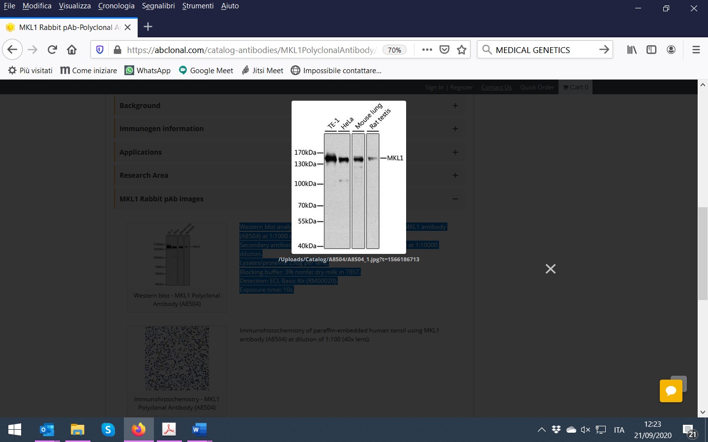 Western blot analysis of extracts of various cell lines, using MKL1 antibody at 1:1000 dilution.
Secondary antibody: HRP Goat Anti-Rabbit IgG (H+L) at 1:10000 dilution.
Lysates/proteins: 25ug per lane.
Blocking buffer: 3% nonfat dry milk in TBST.
Detection: ECL West Pico Plus.
Exposure time: 10s.