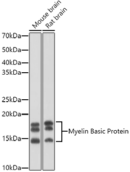 Western blot analysis of various lysates using Myelin Basic Protein Rabbit pAb at 1:1000 dilution.
Secondary antibody: HRP-conjugated Goat anti-Rabbit IgG (H+L) at 1:10000 dilution.
Lysates/proteins: 25μg per lane.
Blocking buffer: 3% nonfat dry milk in TBST.
Detection: ECL West Pico Plus.
Exposure time: 90s.