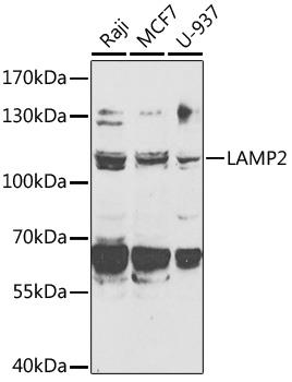 Western blot analysis of extracts of various cell lines, using LAMP2 antibody ) at 1:1000 dilution.
Secondary antibody: HRP Goat Anti-Rabbit IgG (H+L) at 1:10000 dilution.
Lysates/proteins: 25ug per lane.
Blocking buffer: 3% nonfat dry milk in TBST.
Detection: ECL West Pico Plus.