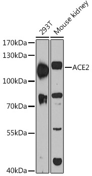 Western blot analysis of extracts of various cell lines, using ACE2 antibody at 1:3000  dilution.
Secondary antibody: HRP Goat Anti-Rabbit IgG (H+L)  at 1:10000 dilution.
Lysates/proteins: 25ug per lane.
Blocking buffer: 3% nonfat dry milk in TBST.
Detection: ECL West Pico Plus.   
Exposure time: 60s.