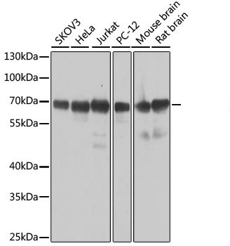 Western blot analysis of extracts of various cell lines, using SAM68 antibody ) at 1:1000 dilution.
Secondary antibody: HRP Goat Anti-Rabbit IgG (H+L) at 1:10000 dilution.
Lysates/proteins: 25ug per lane.
Blocking buffer: 3% nonfat dry milk in TBST.
Detection: ECL west Pico Plus.
Exposure time: 10s.