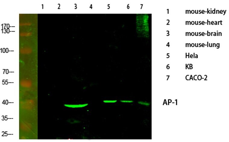 Western blot analysis of various cells using primary antibody diluted at 1:1000 (4°C overnight). Secondary antibody：Goat Anti-rabbit IgG IRDye 800 (diluted at 1:5000, 25°C, 1 hour). Cell lysate was extracted by Minute Plasma Membrane Isolation and Cell Fractionation Kit