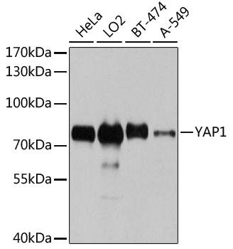 Western blot analysis of extracts of various cell lines, using YAP1 antibody  at 1:1000 dilution.
Secondary antibody: HRP Goat Anti-Rabbit IgG (H+L) at 1:10000 dilution.
Lysates/proteins: 25ug per lane.
Blocking buffer: 3% nonfat dry milk in TBST.
Detection: ECL West Pico Plus. 
Exposure time: 10s.