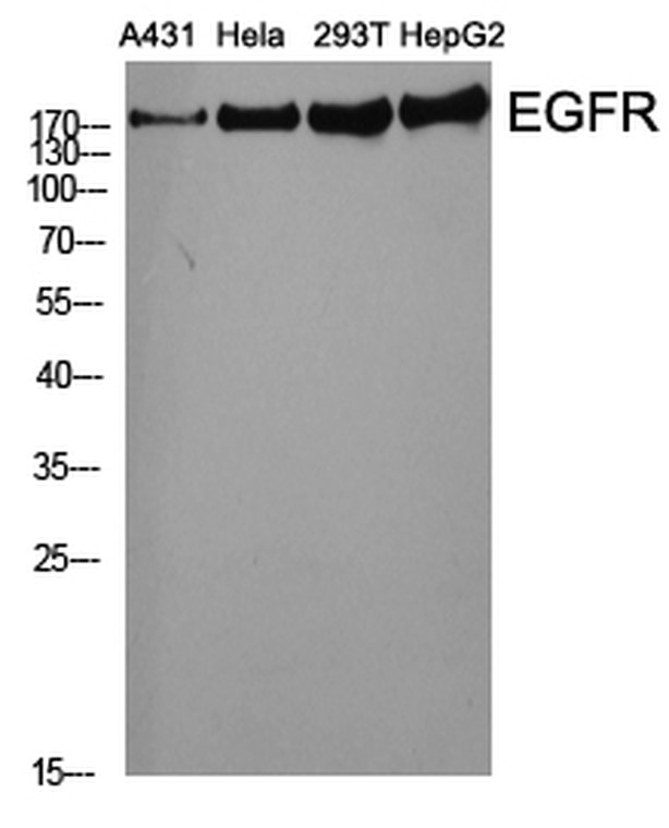 Western Blot analysis of various cell using EGFR antibody at dilution of 1:2000