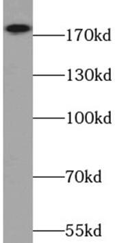 HeLa cells were subjected to SDS PAGE followed by western blot with (ERBB2 antibody) at dilution of 1:300