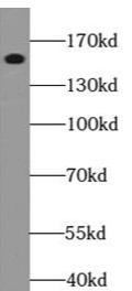 L02 cells were subjected to SDS PAGE followed by western blot with (EGFR-Specific antibody) at dilution of 1:2000
