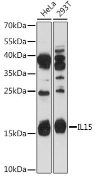 Western blot analysis of extracts of various cell lines,
using IL15 antibody at 1:1000 dilution.
Secondary antibody: HRP Goat Anti-Rabbit IgG
(H+L) at 1:10000 dilution.
Lysates/proteins: 25ug per lane.
Blocking buffer: 3% nonfat dry milk in TBST.
Detection: ECL West Pico Plus.
Exposure time: 180s.