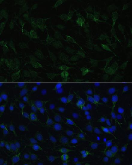 Immunofluorescence analysis 
of C6 cells using TAC1 antibody 
at dilution of 1:100. 
Blue: DAPI for nuclear staining.