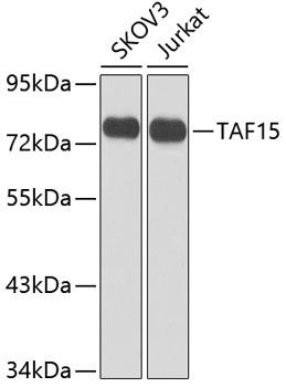 Western blot analysis of extracts of various cell lines, using TAF15 antibody at 1:1000
dilution.
Secondary antibody: HRP Goat Anti-Rabbit IgG (H+L) at 1:10000 dilution.
Lysates/proteins: 25ug per lane. Blocking buffer: 3% nonfat dry milk in TBST.
Detection: ECL West Pico Plus.
Exposure time: 5s.