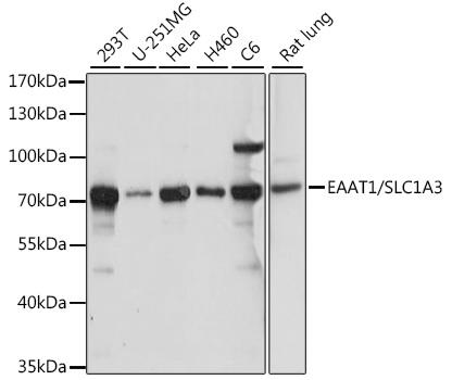Western blot analysis of extracts of various cell lines,
using EAAT1/EAAT1/SLC1A3 antibody
at 1:1000 dilution.
Secondary antibody: HRP Goat Anti-Rabbit IgG
(H+L) at 1:10000 dilution.
Lysates/proteins: 25ug per lane.
Blocking buffer: 3% nonfat dry milk in TBST.
Detection: ECL West Pico Plus.
Exposure time: 10s