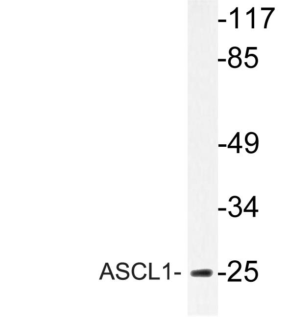 Western blot analysis of lysate from Jurkat cells, using ASCL1 antibody.