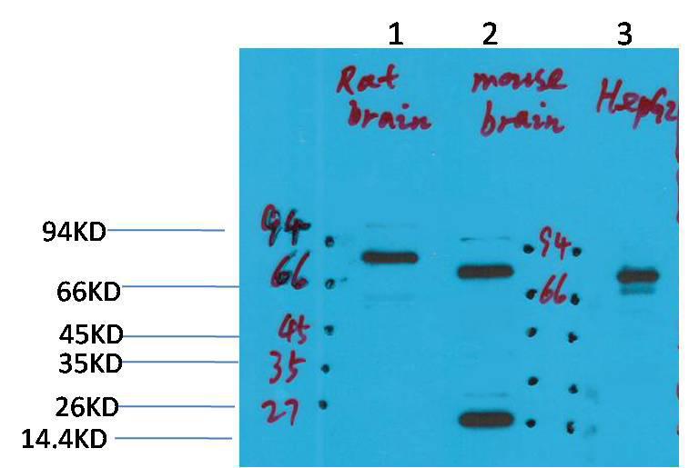 Western blot analysis of 
1) Rat Brain Tissue, 
2)Mouse Brain Tissue, 
3)HepG2 with KCNN2(SK2) Rabbit pAb
 diluted at 1:2,000.