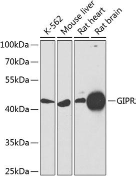 Western blot analysis of extracts of various cell lines, using GIPR antibody at 1:1000
dilution.
Secondary antibody: HRP Goat Anti-Rabbit IgG (H+L) at 1:10000
dilution._Lysates/proteins: 25ug per lane.
Blocking buffer: 3% nonfat dry milk in TBST._Detection: ECL West Pico Plus.
Exposure time: 90s.